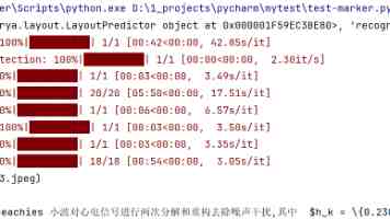 悬疑剧男主终于过上了白宇梦想的生活